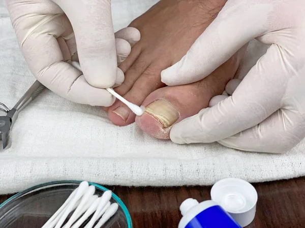 Doktorun Muayenehanesindeki Doktor Ayağındaki Çivileri Inceledi — Stok fotoğraf