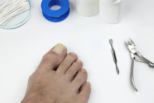 Doktorun Muayenehanesindeki Doktor Ayağındaki Çivileri Inceledi — Stok fotoğraf
