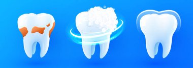 3D gerçekçi vektör sağlıklı parlayan diş. Diş plağı iyileştirme ve koruma kalkanı. Diş bakımı, koruma ve beyazlatma. Vektör illüstrasyonu