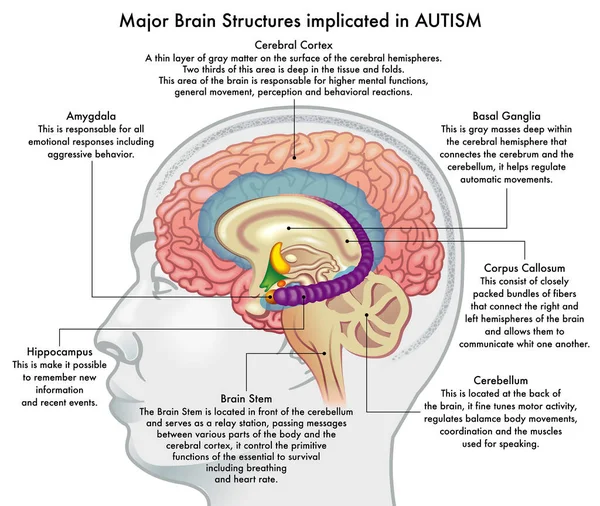 Medical Illustration Showing Major Brain Structures Implicated Autism Spectrum Disorder Vector Graphics