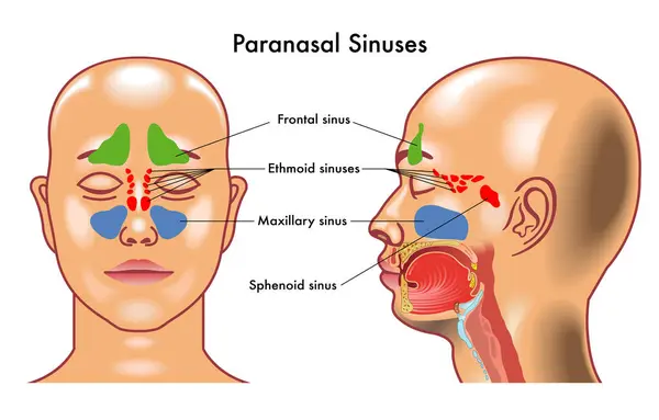 Medical Diagram Paranasal Sinuses Human Head Stock Vector