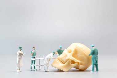 Minyatür insanlar. Doktor gri arka planda dev bir insan kafatası, Bilim ve Tıp Konsepti.