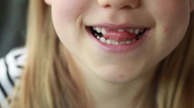 Kız neşeyle dilini uzatır ve sırayla eksik dişini göstererek gülümser. Pediatrik dişçilik kavramı, bebek dişlerinin değiştirilmesi.