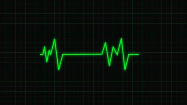 Рендеринг Графіка Серцевих Скорочень Серцебиття Екрані Кардіографічного Монітора Зелена Хвиля — стокове фото