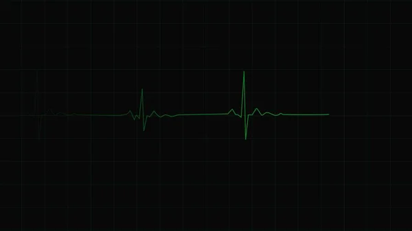 Grön Pulsmätare Med Signal Återgivning Ekg Övervakning Kardiogram Hjärtslag Ekg — Stockfoto