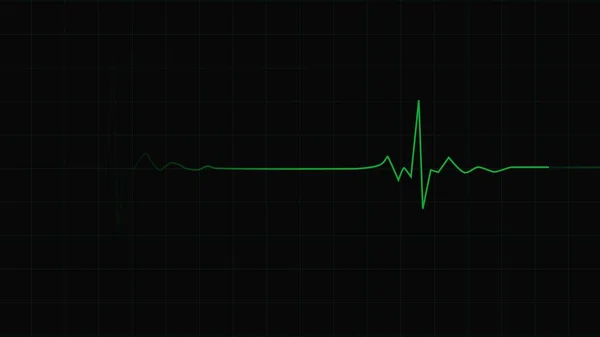 Monitor Pulso Green Heart Com Sinal Renderização Ecg Cardiograma Monitorização — Fotografia de Stock