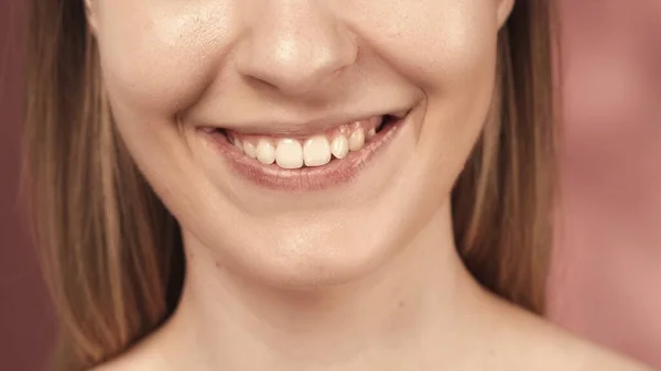 Belle Sourire Féminin Bonne Santé Près Santé Dentaire Blanchiment Prothèses — Photo