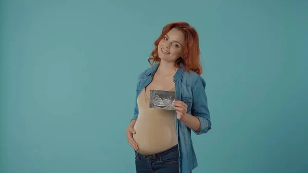妊娠中の女性は超音波スキャンを受けます 青い背景のスタジオでハッピーヨン女性 優しさ 成長するという概念 — ストック写真