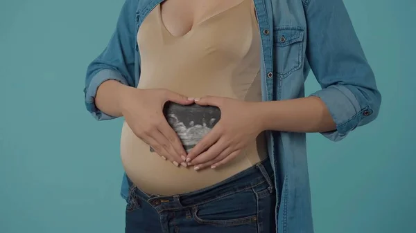 Gravid Kvinna Håller Ultraljudsundersökning Nära Magen Med Händerna Vikta Form — Stockfoto