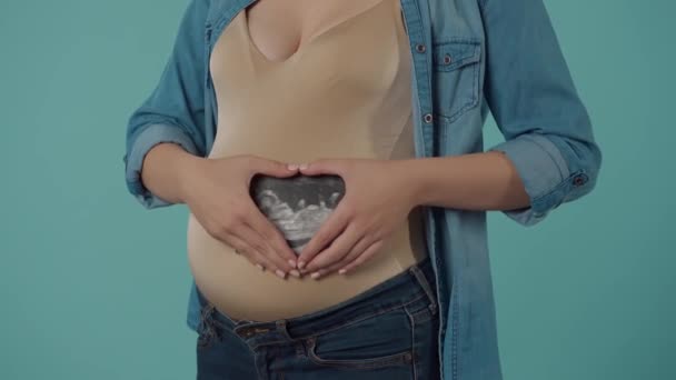 Gravid Kvinna Håller Ultraljudsundersökning Nära Magen Med Händerna Vikta Form — Stockvideo