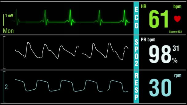 心拍数 圧力率 酸素飽和 呼吸の徴候 モックアップ バナー 病院のIcuモニター 医学と科学クリップ カーディオグラフの映像 患者の重要な兆候を監視する — ストック動画