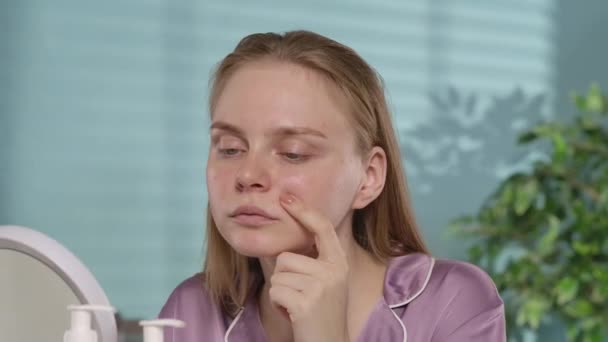 Rozrušená Mladá Žena Ukazující Prst Své Problematické Pleti Obličeje Pupíncích — Stock video