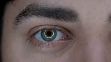 Genç bir adamın gözü, yakın çekim. Cihazların uzun süre kullanılmasından dolayı büyümüş gözbebekleri. Kuru göz sendromu. Sağlık kavramı