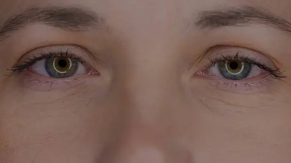 一个年轻女人的眼睛 宏观拍摄 由于长期使用小玩意 瞳孔增大 干眼症健康 美丽和关怀的概念 — 图库照片