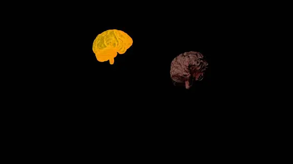 Nsan Beyni Onun Siyah Arka Plandaki Titreşimli Yansıması Tıp Beyin — Stok fotoğraf