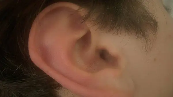 男性の右耳 音の聴覚と知覚を担当する身体の部分 人間の解剖学 聴覚の概念の問題 マクロショット — ストック写真