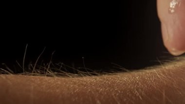 Makro deri ve saç dokusu. Derinin üzerinden bir buz küpü geçer ve arkasında ıslak bir iz bırakır. Yumuşak ışığı olan karanlık bir stüdyo cilt dokusunu ve bireysel kılları ön plana çıkarır..