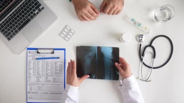 Bir doktor masası, röntgen görüntüleri ve çeşitli tıbbi araçların yer aldığı bir tıbbi danışma sahnesi, profesyonel bir sağlık ortamını ön plana çıkarıyor. Üst çekim