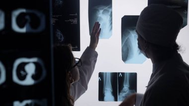 Sağlık uzmanları röntgen görüntülerini inceliyor ve tartışıyor, doğru tanı ve bir tıbbi tesiste etkili tedavi planlamasına odaklanıyorlar..