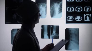 Işık kutusunda birden fazla X ışını görüntüsünü inceleyen bir doktorun silüeti, panoya notlar yazıyor..