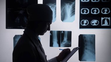 Işık kutusunda birden fazla X ışını görüntüsünü inceleyen bir doktorun silüeti, panoya notlar yazıyor..