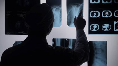 Bir radyolog, bir ışık kutusundaki röntgen görüntülerini inceleyerek, tıbbi teşhisin kritik yönlerini vurguluyor..