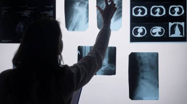 Bir tıp uzmanı röntgen ve tarama görüntülerini analiz ediyor, hasta durumlarının doğru teşhisi ve değerlendirmesine odaklanıyor.