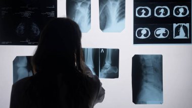 Bir doktor, sağlık durumlarını teşhis etmek için röntgen görüntülerini inceler..