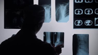 Bir radyolog, bir ışık kutusundaki röntgen görüntülerini inceleyerek, tıbbi teşhisin kritik yönlerini vurguluyor..