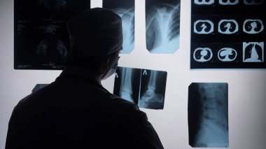 Bir sağlık çalışanı, ışık panosundaki röntgen taramalarını inceleyerek hastanın teşhisine odaklanıyor..