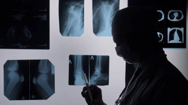 Siluetteki bir doktor bir ışık kutusundaki röntgen görüntülerini inceleyerek tıbbi analizlere odaklanıyor..