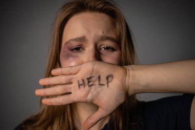 Aile içi şiddet durumlarında acil yardım ve destek ihtiyacını gösteren ilgi çekici bir görüntü.