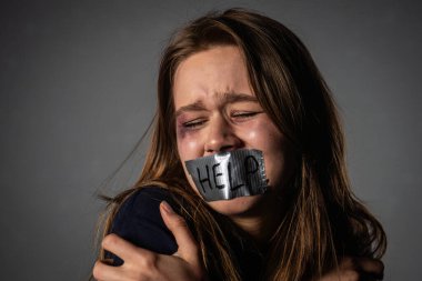 Yüzü morarmış bir kadın ağzını bantla kapatarak ağlıyor ve çaresizce yardıma ihtiyacı olduğunu söylüyor..