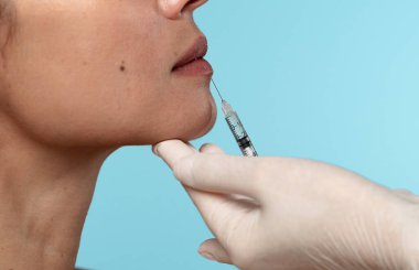 Kozmetik tedavide hassasiyet ve bakımı vurgulayan şırınga ile bir dudak geliştirme prosedürünün ayrıntılı görünümü.