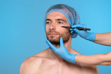 Bir adam kozmetik bir prosedüre hazırdır. Başlık takar ve yönlendirme için yüzünde işaretler olur. Erkekler için estetik ameliyatlar, estetik cerrahi ve cilt bakımı ile ilgili içerik için ideal.