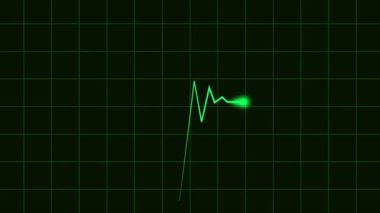 EKG monitöründeki kalp atışı videosu. Kalp atışı tanıları