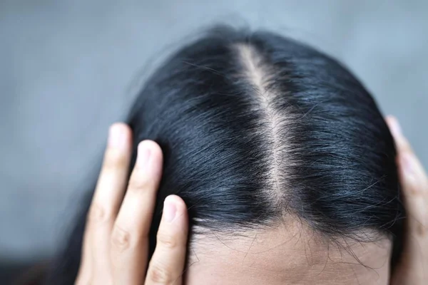 Dziewczyna Dotykając Jej Włosy Zbliżenie Białym Tle Koncepcja Wypadania Włosów — Zdjęcie stockowe