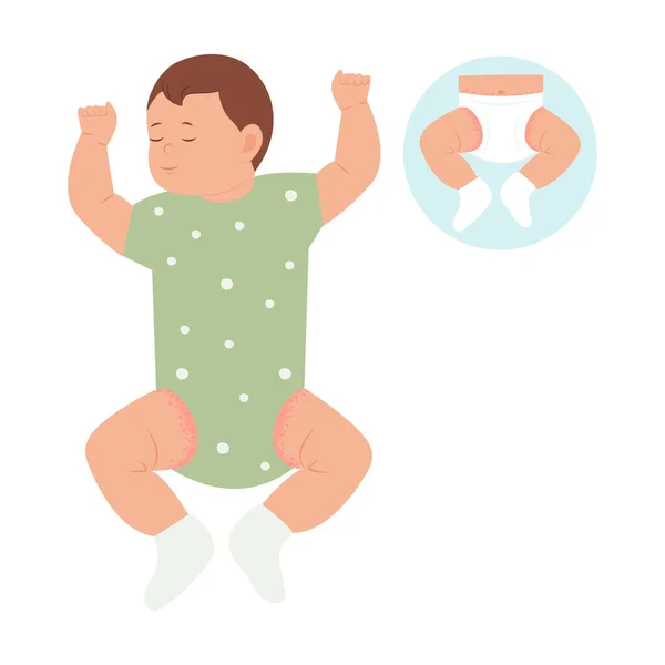 Bebek Bezi Döküntüsü Deri Döküntüsü Alerji Çocukların Cilt Kızarıklığı Dermatolojik — Stok Vektör