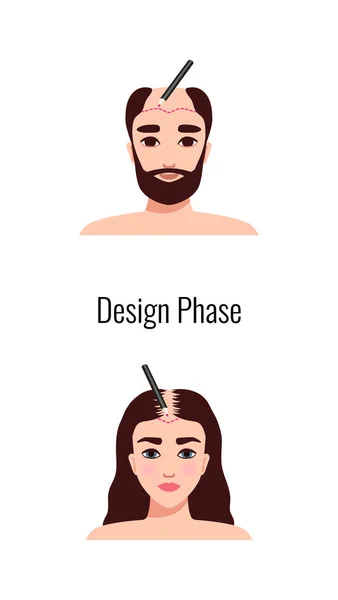 Alopecia Hair Transplantation Composition Infographic Image Hair Restoration Procedures Text — Vettoriale Stock