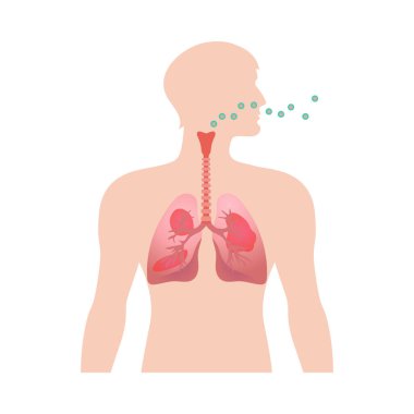 Asthma composition with isolated medical infographic image of chronic disease on blank background vector illustration