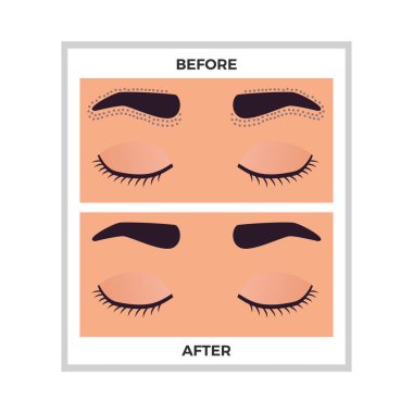 Düz vektör illüstrasyonundan önce ve sonra kaş aldırma alanı