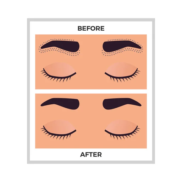 Hair Removal Eyebrows Area Flat Vector Illustration — Stock Vector