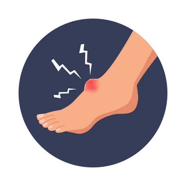 Verletzung Des Menschlichen Fußes Flache Runde Ikone Vektor Illustration — Stockvektor
