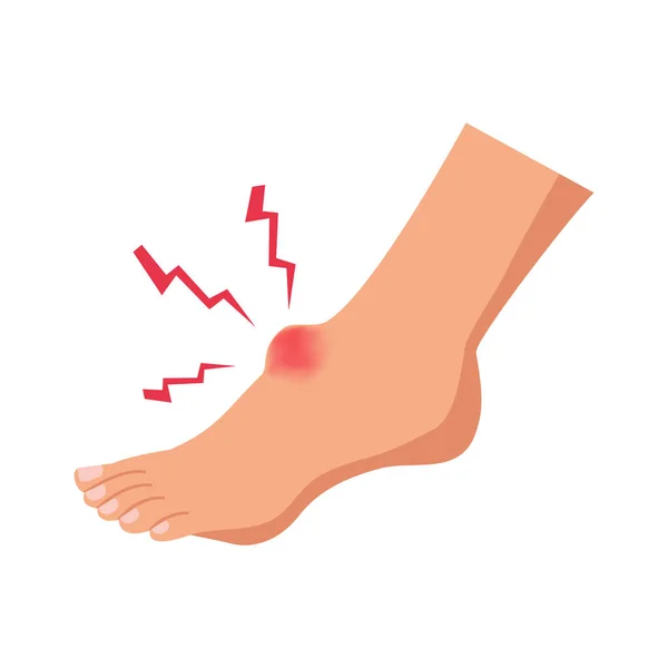 Schmerzhafte Fußverletzung Auf Weißem Hintergrund — Stockvektor