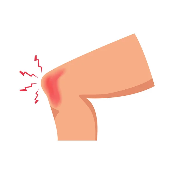 Painful Knee Injury Flat Vector Illustration — Stock Vector