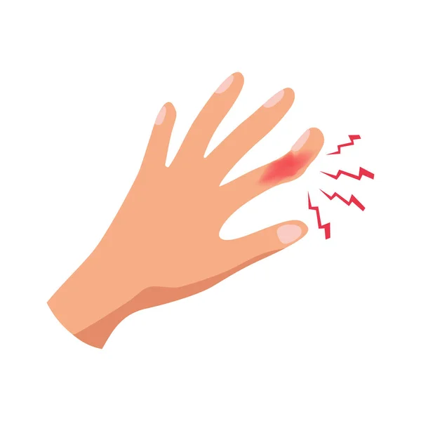 Bolestivé Poranění Prstu Plochý Vektor Ilustrace — Stockový vektor