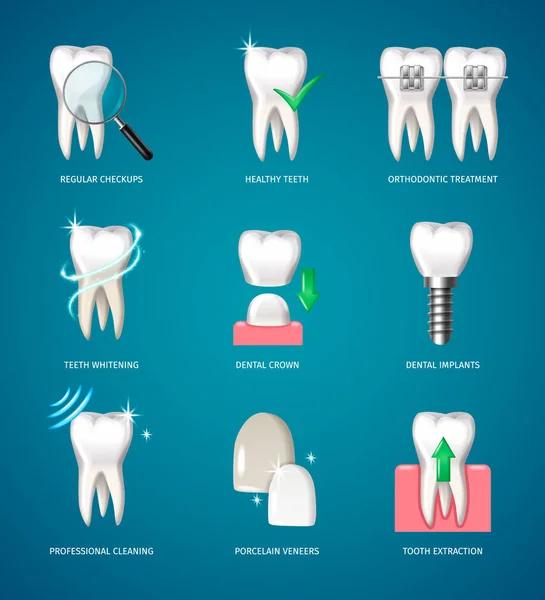 Реалистичные Иконки Лечения Зубов Помощью Зубных Имплантатов Искусственных Виниров — стоковый вектор