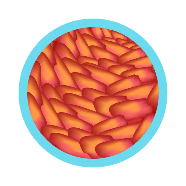 平面矢量插画中的胃炎症状圆形图标 — 图库矢量图片