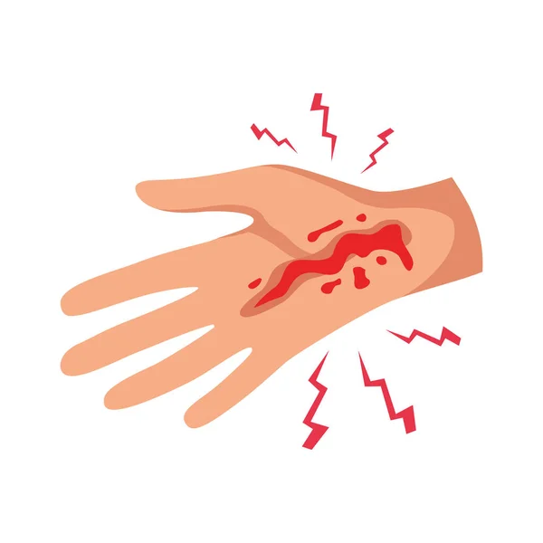 Lesão Mão Sangramento Corte Plano Vetor Ilustração — Vetor de Stock