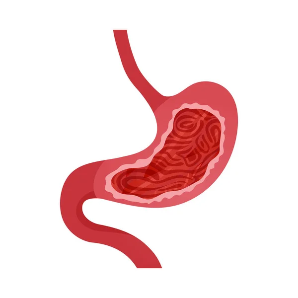 Icono Plano Síntoma Gastritis Ilustración Del Vector Fondo Blanco — Vector de stock